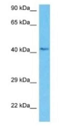 NADKD1 Rabbit anti-Human, Polyclonal, Novus Biologicals 100 &mu;g | Buy Online | Novus Biologicals | Fisher Scientific
